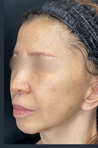 手術前の状態 その1