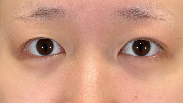 手术前的状态 其一