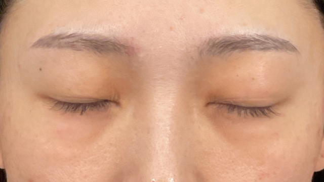 Postoperative Condition Part 1