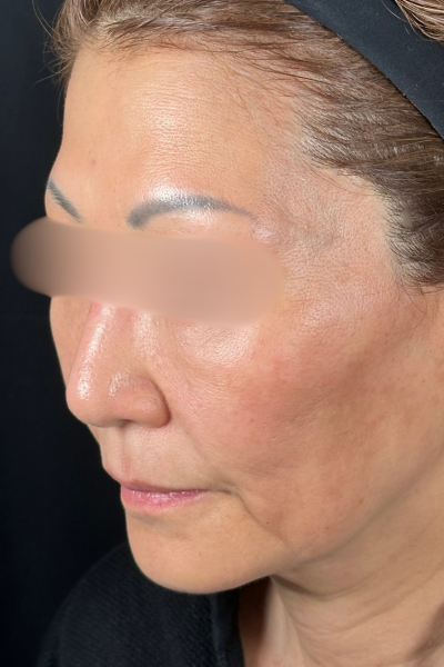 手術前の状態 その1