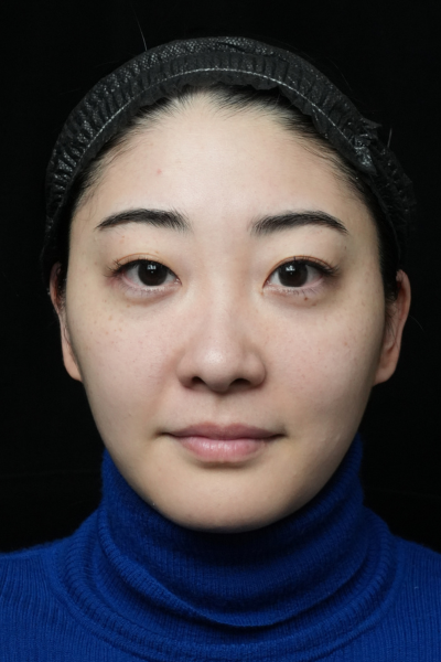 手术前的状态 其一