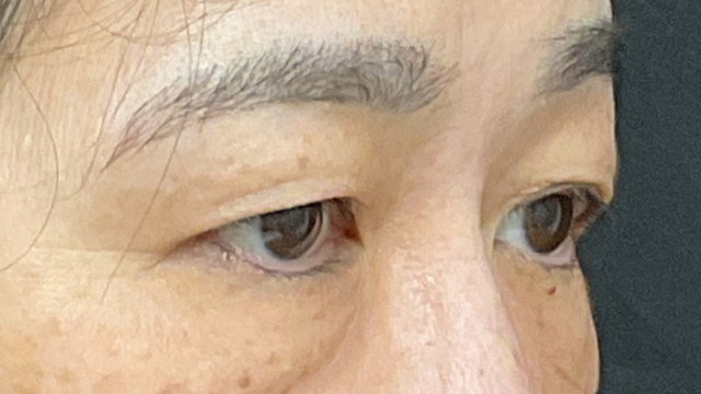 Postoperative Condition Part 1