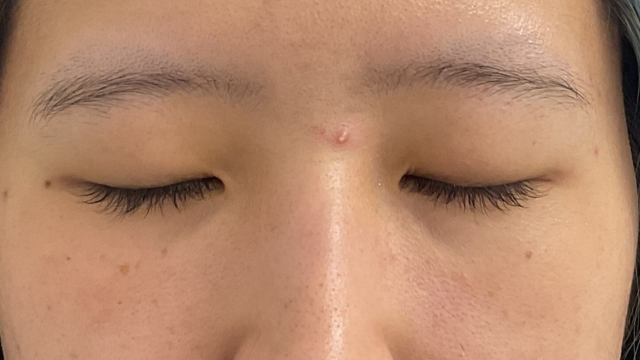 手術前の状態 その1