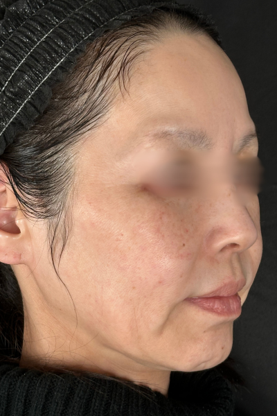 手術前の状態 その1