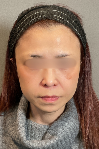 Postoperative Condition Part 1