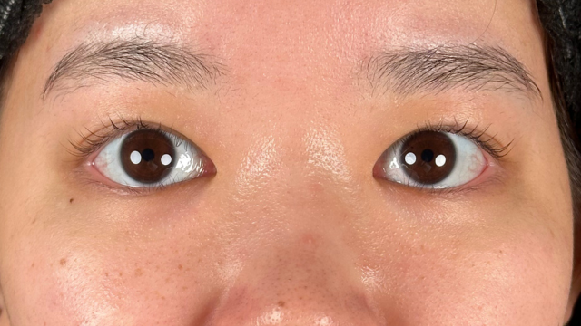 手术前的状态 其一