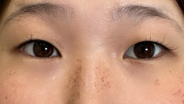 Postoperative Condition Part 1