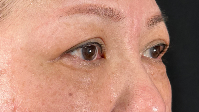 Postoperative Condition Part 1