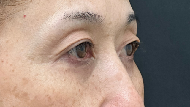 手术前的状态 其一