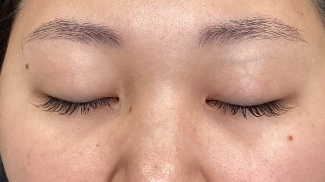 Postoperative Condition Part 1