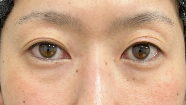 手术前的状态 其一