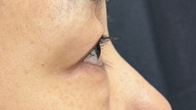 Postoperative Condition Part 1