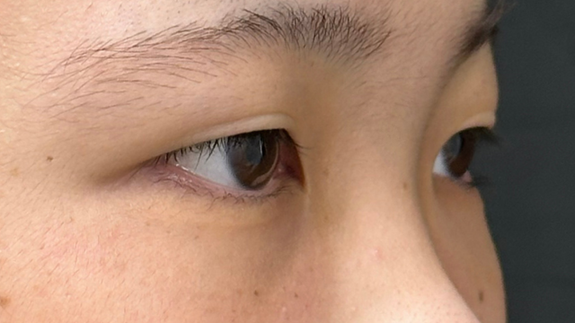 Postoperative Condition Part 1