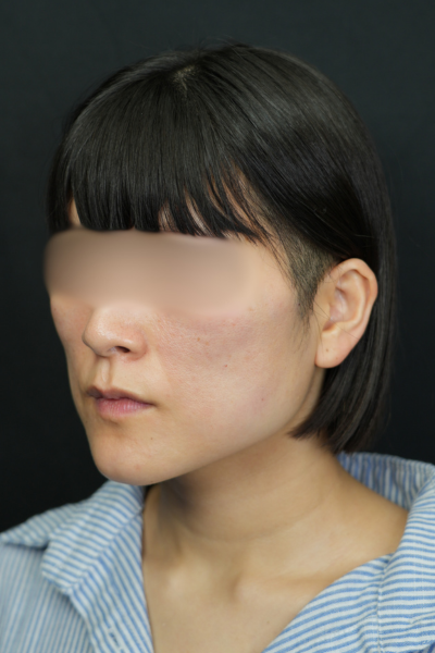 手術前の状態 その1