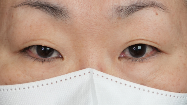 手術前の状態 その1