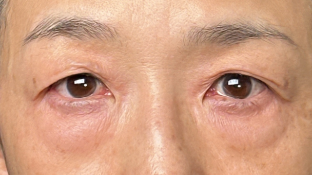 手术前的状态 其一