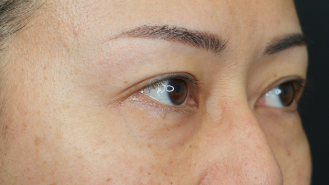 Postoperative Condition Part 1