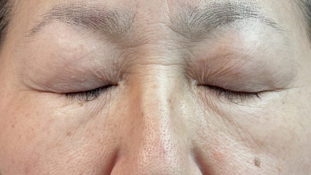 手术前的状态 其一