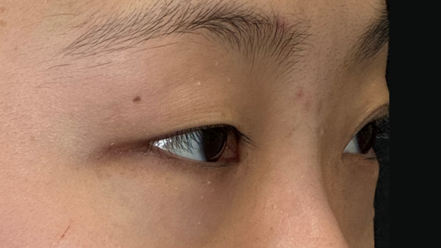 手術前の状態 その1