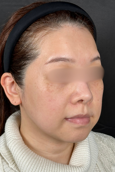 手術前の状態 その1