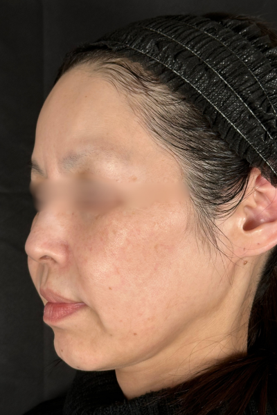 手術前の状態 その1