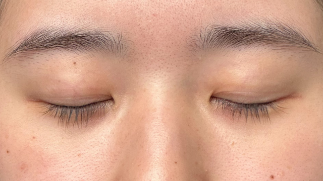 手术前的状态 其一