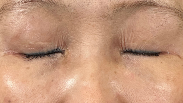 手术前的状态 其一