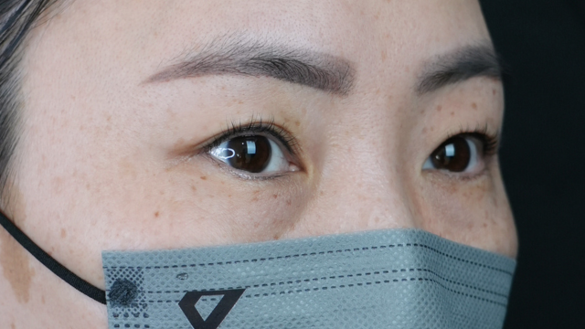 Postoperative Condition Part 1