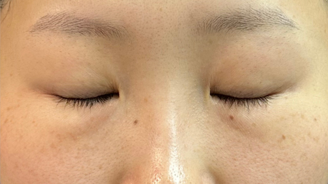 手术前的状态 其一