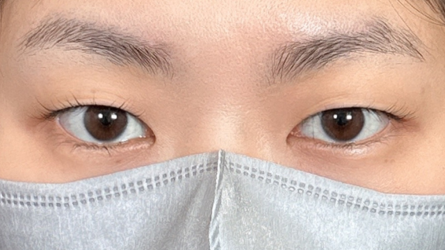 手术前的状态 其一