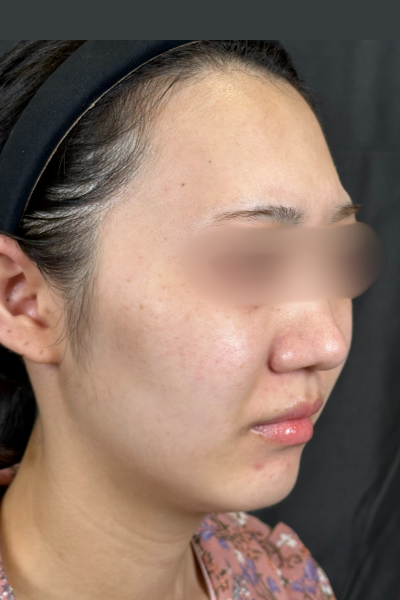 手術前の状態 その1