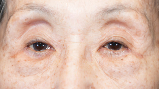 Postoperative Condition Part 1