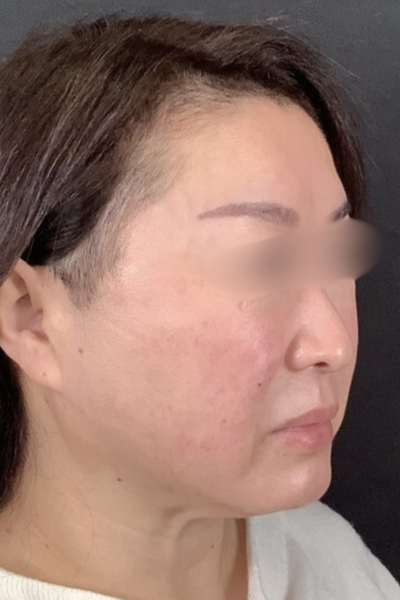 手術前の状態 その1