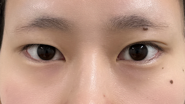 Postoperative Condition Part 1