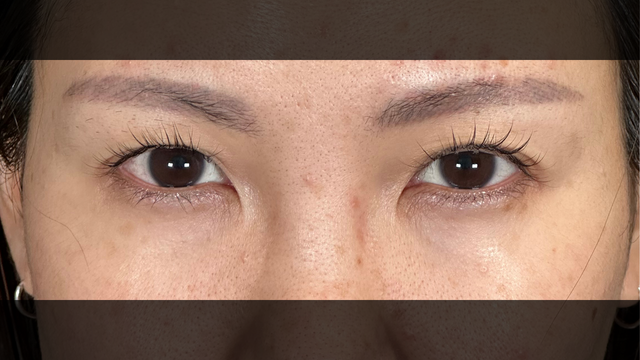 Postoperative Condition Part 1