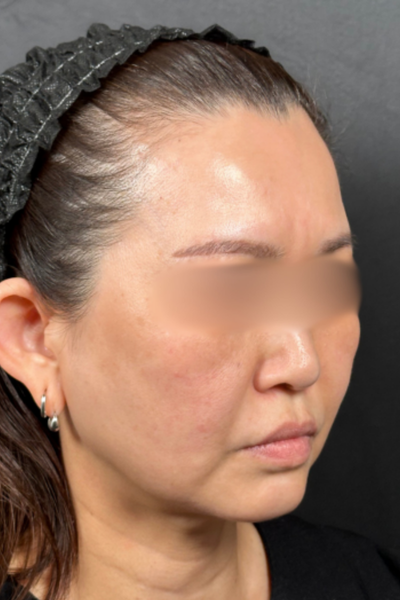 手术前的状态 其一