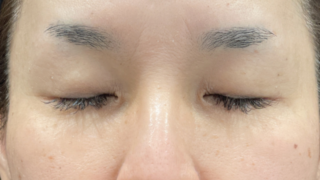 手术前的状态 其一