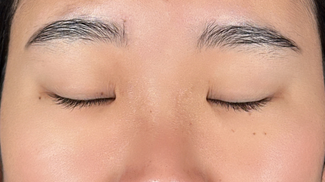 手术前的状态 其一