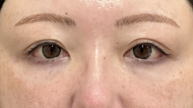 手术前的状态 其一