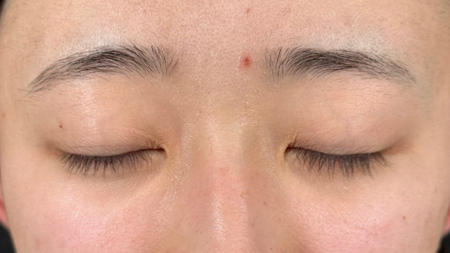 手术前的状态 其一