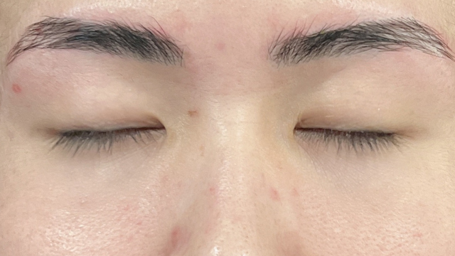 手術前の状態 その1