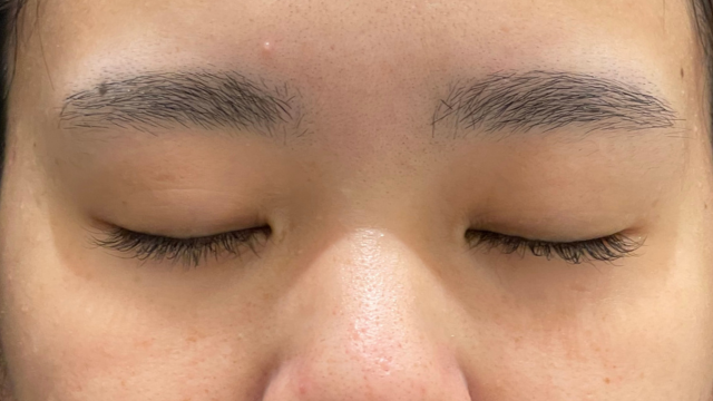 Postoperative Condition Part 1