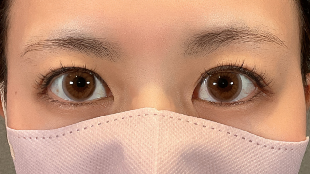 手术前的状态 其一