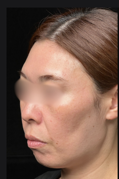 手術前の状態 その1