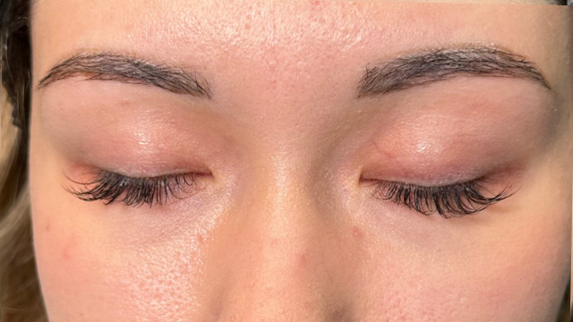 手术前的状态 其一