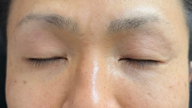 手术前的状态 其一