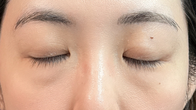 手术前的状态 其一