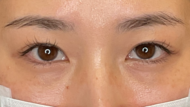 手术前的状态 其一