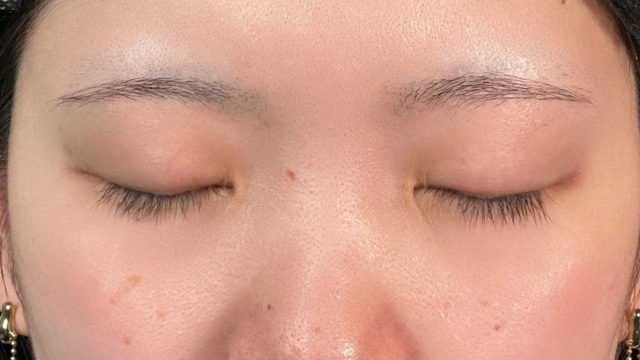 手术前的状态 其一