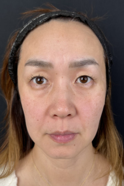 手术前的状态 其一